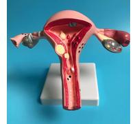KXJSYL Tool 1pc modèle d'ovaire utérin pathologique Humain modèle de Structure de Section transversale utérus Anatomie Anatomique organe féminin Outil d'étude pédagogique