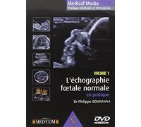L ECHOGRAPHIE FOETALE Normale VOL 1