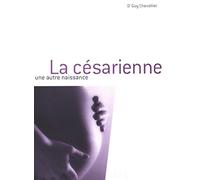La césarienne : Une autre naissance