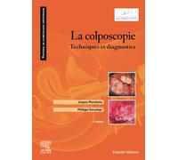 La colposcopie: Techniques et diagnostics
