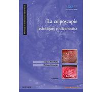 La colposcopie: Techniques et diagnostics