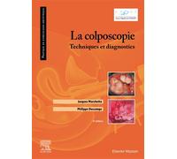La colposcopie Techniques et diagnostics - Jacques Marchetta - Elsevier Masson - broché - Etude