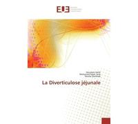 La Diverticulose jéjunale - Houssem Harbi - Universitaires Europeennes - broché - Livre