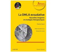 La Dmla Exsudative - Nouvelles Imageries Et Stratégies Thérapeutiques