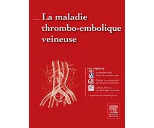 La maladie thrombo-embolique veineuse