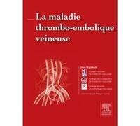 La maladie thrombo-embolique veineuse Société Française de Médecine Vasculaire (Auteur), Collège des enseignants de médecine vasc (Auteur), Philippe Lacroix (Auteur)