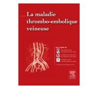 La maladie thrombo-embolique veineuse - Société Française de Médecine Vasculaire - Elsevier Masson - cartonné - Etude