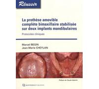 La prothèse amovible complète bimaxillaire stabilisée sur deux implants mandibulaires: Protocoles cliniques