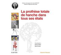 La prothèse totale de hanche dans tous ses états: Dans Tous Ses Etats
