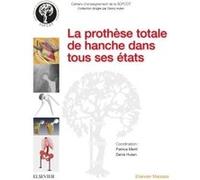 La prothèse totale de hanche dans tous ses états Professeur Patrice Mertl (Auteur), Denis Huten (Auteur)