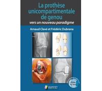 LA PROTHESE UNICOMPARTIMENTALE DE GENOU. VERS UN NOUVEAU PARADIGME