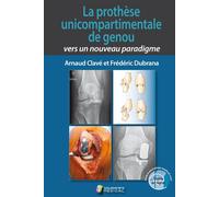 La prothese unicompartimentale de genou. vers un nouveau paradigme - Arnaud Clavé - Sauramps Medical - broché - Scolaire / Universitaire