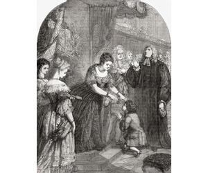 La reine Anne touchant le jeune Samuel Johnson pour le mal. Samuel Johnson a contracté une scrofule également appelée le mal du roi parce qu'on croyait que si touché par un monarque, il serait guéri