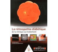 La Rétinopathie Diabétique