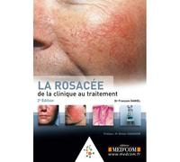 La rosacee. de la clinique au traitement - François Daniel - Med'com - broché - Etude