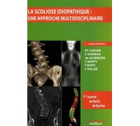 La Scoliose Idiopathique : Une Approche Multidisciplinaire
