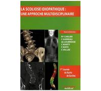La Scoliose Idiopathique : Une Approche Multidisciplinaire