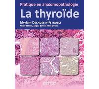 La thyroïde: Pratique en anatomopathologie
