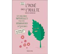 L'acné chez l'adulte - Les solutions naturelles pour s'en débarrasser en 5 semaines - Ca marche aussi sur les ados !