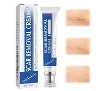 LAKVIL Scar Removal Cream,Crème Cicatrisante Post Opératoire,Utilisée pour l’Hyperplasie Cicatricielle et le lissage des Cicatrices,Adapté aux Femmes Enceintes（B）