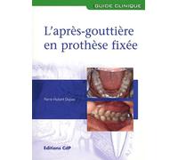 L'après-gouttière en prothèse fixée