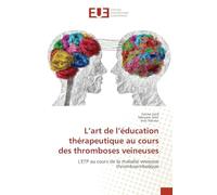 L'art de l'éducation thérapeutique au cours des thromboses veineuses