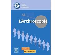 L'arthroscopie