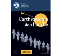 L'arthroscopie de la hanche