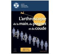 L'arthroscopie De La Main, Du Poignet Et Du Coude