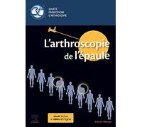L'arthroscopie de l'épaule