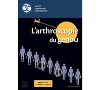 L'arthroscopie du genou