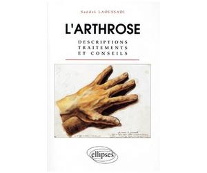 L'arthrose - Descriptions, Traitements Et Conseils
