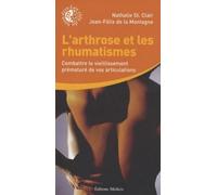 L'arthrose et les rhumatismes : Combattre le vieillissement prématuré de vos articualtions