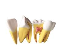 LBYLYH Modèle d'enseignement des Dents - Granule Dentaire Granule Dental Granule Dental - Modèle de Dents orales - pour l'enseignement médical