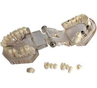 LBYLYH Modèle Tooth Implant, modèle Dental Implant Dentaire avec Dentiste de la dent Pont restauré d'apprentissage 10 X 7 X 6 cm