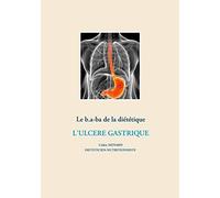 Le b.a-ba de la diététique pour l'ulcère gastrique