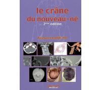 Le crane du nouveau ne 2e ed - LALAUZE POL/BER - Sauramps Medical - broché - Etude