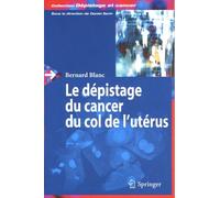 Le dépistage du cancer du col de l'utérus