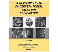 Le Developpement Du Cerveau Foetal : Atlas Irm Et Biometrie