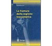 Le Fratture Della Regione Trocanterica