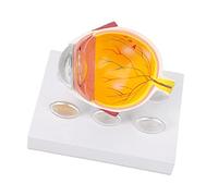 Le Modèle Anatomique de L'œil Humain Agrandi Montre avec Précision Le Modèle Oculaire D'anatomie du Globe Oculaire Médical à Lentille Réaliste pour L'enseignement Scientifique et