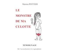 Le monstre de ma culotte: TEMOIGNAGE : De l'accouchement à la vaginoplastie