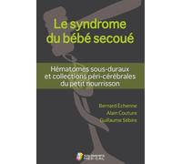 Le syndrome du bebe secoue- hematomes sous-duraux et coll peri-cerebrales du pet Hématomes sous-duraux et collections péri-cérébrales du petit nourrisson - ECHENNE/SEBIRE - Sauramps Medical - broché -