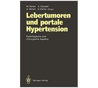 Lebertumoren Und Portale Hypertension