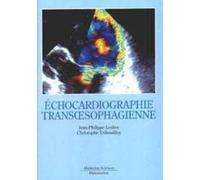L'échocardiographie Transoesophagienne