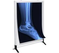 LED X-Ray Film Viewer Light Box - Ultra Thin Illuminator with Acrylic Panel, Adjustable Knob Dimming, Flicker-Free Uniform Lighting for Clinics, Hospitals & Dental Offices(75.5 * 49.5cm)