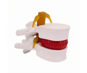 LeeQinersw Modèle Vertèbres Lombaires Interactif | Éducatif, Modèle Prolapsus discal Discale Lombaire, Flexible, pr Cabin Médical, Laboratoire D'anatomie, Orthopédistes