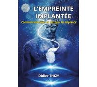 L'empreinte implantée: Comment identifier et nettoyer les implants