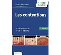 Les Contentions - Protocoles Cliniques Directs Et Indirects