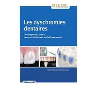 Les dyschromies dentaires – Un diagnostic précis pour un traitement esthétique réussi